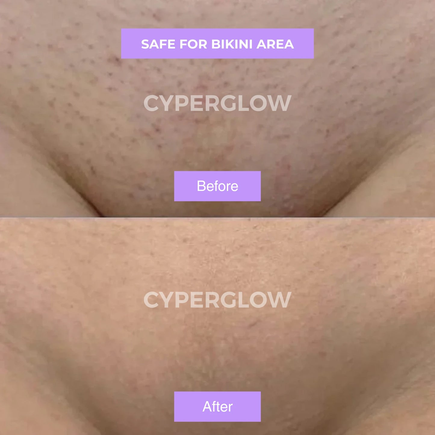 CyperGlow™ - Cyperus Rotundus Skin Serum