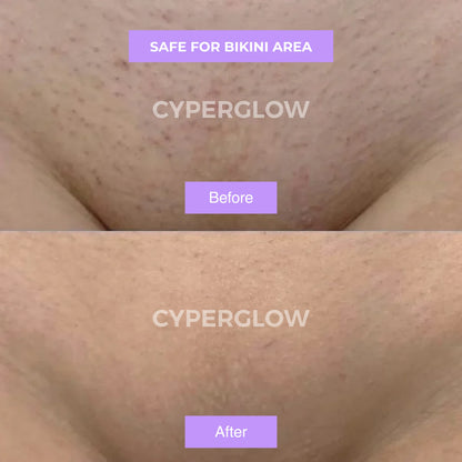 CyperGlow™ - Cyperus Rotundus Skin Serum